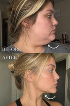 Avyra Pro Facial & Neck Sculpting Device